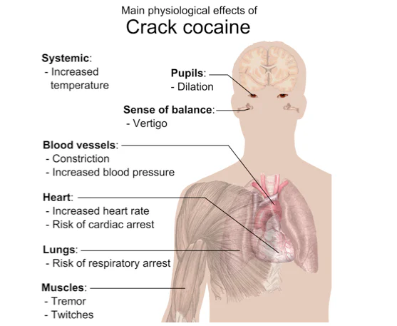 Effects of cocaine shown in a diagram on a human body
